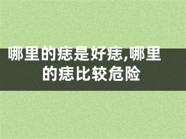 哪里的痣是好痣,哪里的痣比较危险